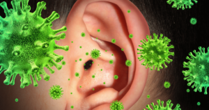 Types of Ear Infections