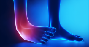 When to suspect an Ankle Sprain?